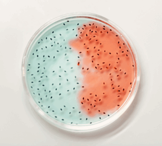 Proces ponownego tworzenia się biofilmów bakteryjnych w umywalkach szpitalnych