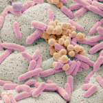 Wieloośrodkowe badanie mikrobiomu toalet szpitalnych: ekspozycja na antybiotyki sprzyja bakteriom z rodzaju Enterococcus kosztem naturalnej mikroflory