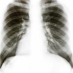 Zrównoważony rozwój w pracowni radiologii zabiegowej: implikacje środowiskowe i finansowe