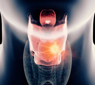 Zastosowanie zarządzania hałasem oddziałowym u pacjentów z rakiem krtani po laryngektomii: badanie retrospektywne