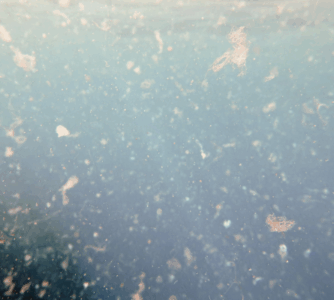 Cząstki mikroplastiku w ściekach szpitalnych jako potencjalne nośniki wirusów chorobotwórczych – analiza występowania, charakterystyka cząstek i ryzyko epidemiologiczne