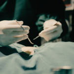 Dym zabiegowy jako czynnik narażenia zdrowotnego wśród personelu szpitala