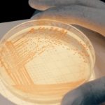 Serratia marcescens na oddziałach intensywnej terapii: epidemiologia molekularna, utrzymywanie się dzięki biofilmowi, oporność na środki przeciwdrobnoustrojowe i nadzór genomowy