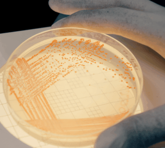 Serratia marcescens na oddziałach intensywnej terapii: epidemiologia molekularna, utrzymywanie się dzięki biofilmowi, oporność na środki przeciwdrobnoustrojowe i nadzór genomowy