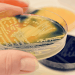 Długoterminowy nadzór środowiskowy nad Pseudomonas aeruginosa w szpitalnym systemie dystrybucji wody: zmiany częstości występowania, tworzenia biofilmu i wrażliwości na antybiotyki
