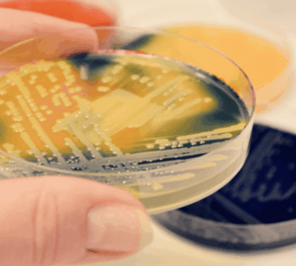 Długoterminowy nadzór środowiskowy nad Pseudomonas aeruginosa w szpitalnym systemie dystrybucji wody: zmiany częstości występowania, tworzenia biofilmu i wrażliwości na antybiotyki
